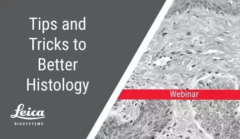 Tips and Tricks to Better Histology Webinar Thumbnail