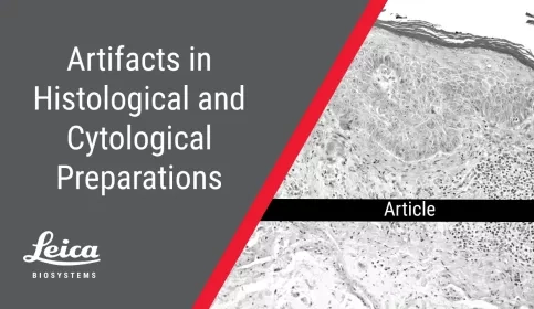 Artifacts in Histological and Cytological Preparation Article Thumbnail