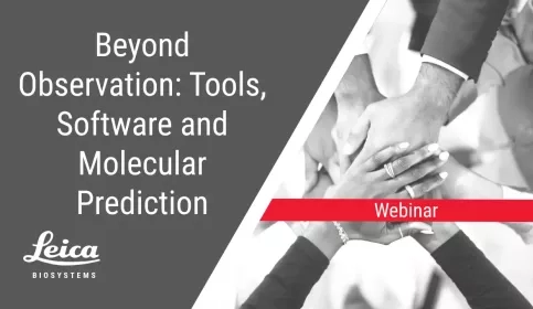 Beyond Observation: Tools, Software and Molecular Prediction Webinar Thumbnail
