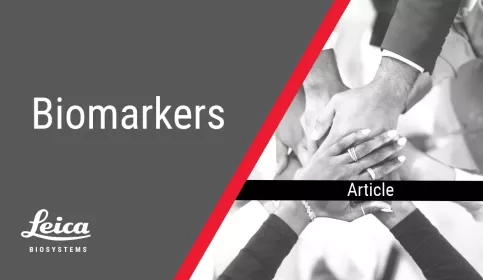 Biomarkers Article Thumbnail