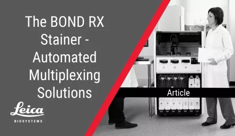 BOND RX Automated Multiplexing Article Thumbnail