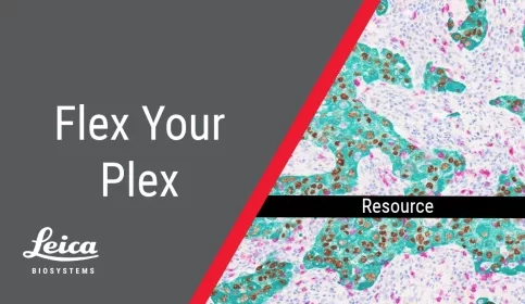 Flex Your Plex Thumbnail