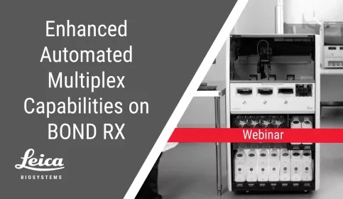 Enhanced Automated Multiplex Capabilities on Leica Biosystems BOND RX System Webinar Thumbnail