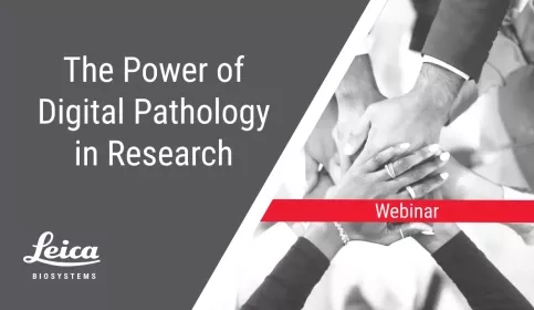 The Power of Digital Pathology in Research Webinar Thumbnail