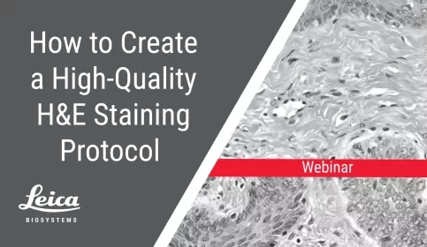How to Create a High-Quality H&E Staining Protocol Webinar Thumbnail