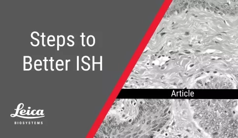 Steps to Better ISH staining thumbnail