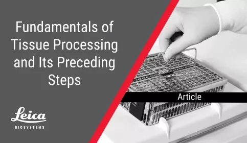 Fundamentals of Tissue Processing and Preceding Steps Article Thumbnail