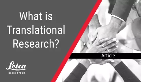 What is Translational Research Article Thumbnail