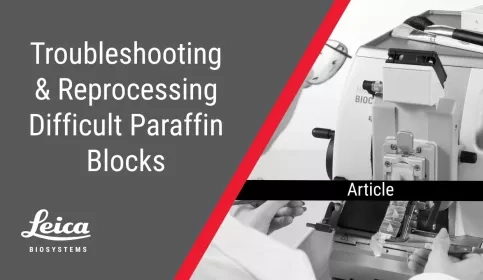 Troubleshooting & Reprocessing Difficult Paraffin Blocks Article Thumbnail