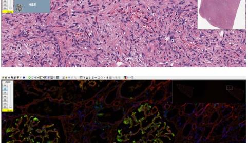 Aperio ImageScope – Software zur Objektträgeransicht in der Pathologie