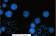CytoVision-DX-InterMet-FISH1