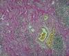 Hematoxylin and Van Gieson, colon (inset hematoxylin and Van Gieson manual staining)