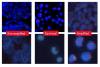 Images of sections stained using the Leica HER2 FISH System Images of sections stained using the Leica HER2 FISH System