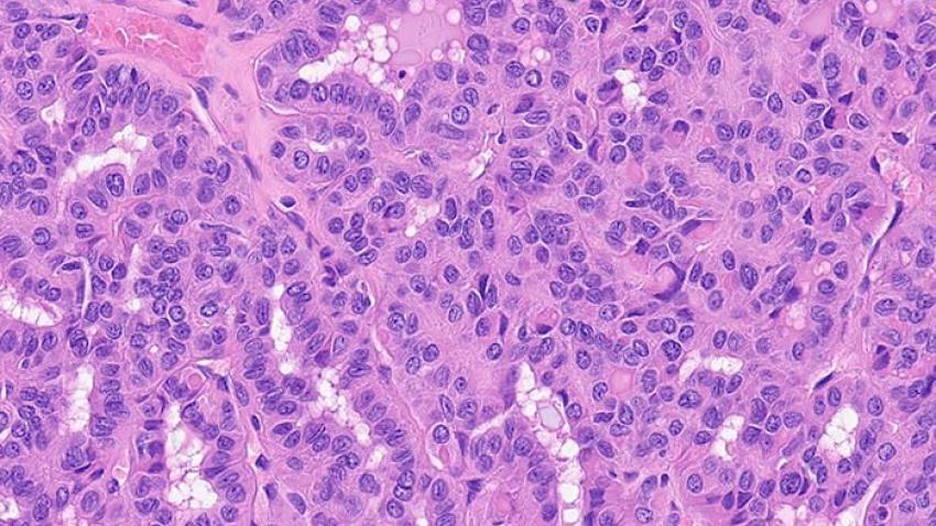 Cellular Groves (Thyroid)