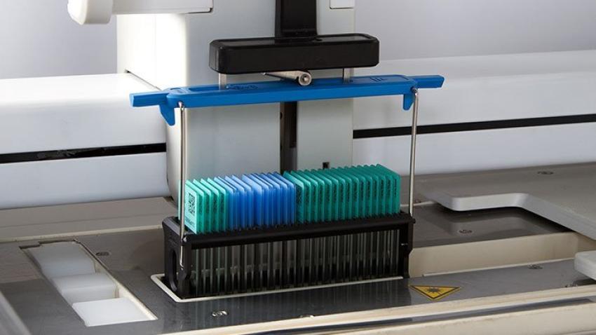 Precise Reagent Management and Cost Control with Single Slide Counting