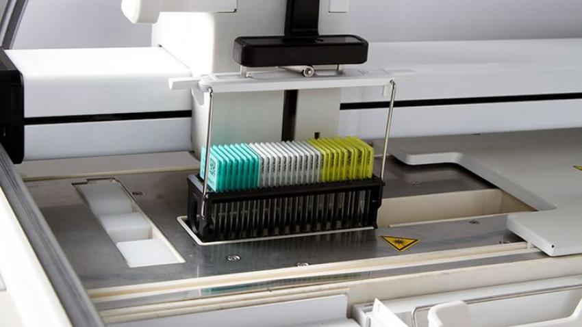 Precise Reagent Management and Cost Control with Unique Single Slide Counting