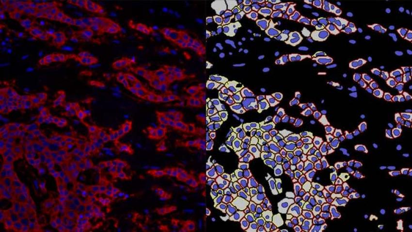 AI-Powered-Nuclear-and-Membrane-Segmentation