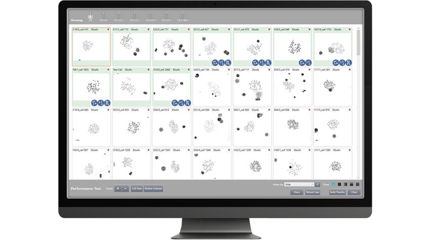 CytoVision-DX-Automated-Intelligence-Human-Expertise-2