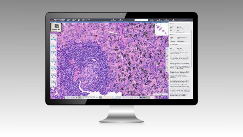 Aperio HALO AP DX Feature Faster Diagnosis