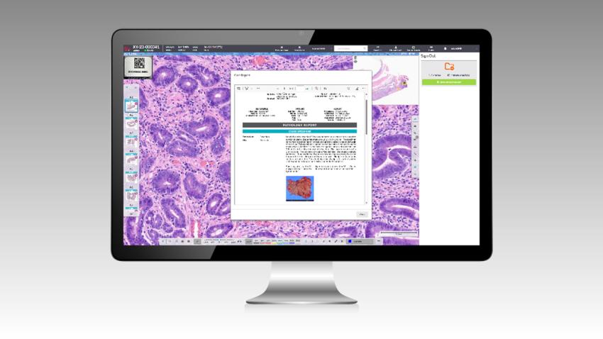 Aperio HALO AP DX Feature Integrated Reporting