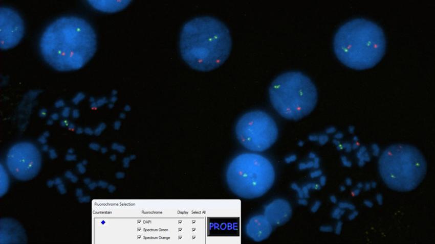 CytoVision DX InterMet FISH1