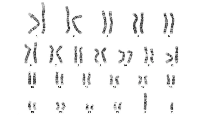CytoVision-DX-Karyo-1-ideos