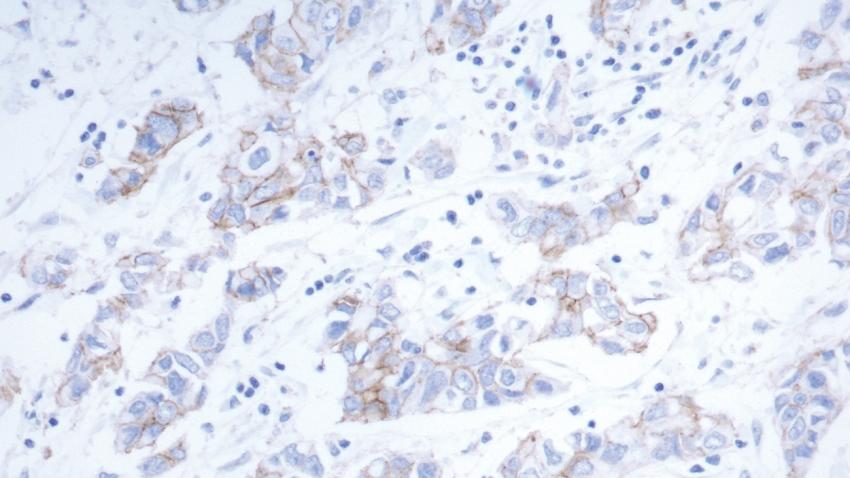 Bond Oracle HER2 IHC System Laboratory Efficiency