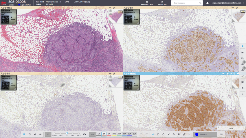 Aperio HALO AP Multislide synchronization